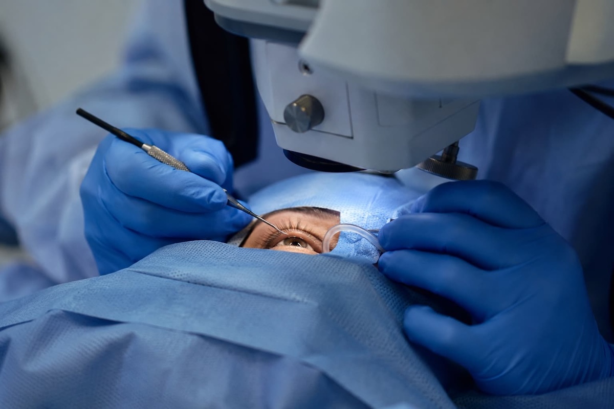 Oftalmólogo realizando una cirugía refractiva en Aguascalientes a un paciente de manera segura y profesional.
